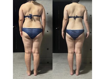 ヴィナーレ(VINARE)/30代のお客様 4カ月