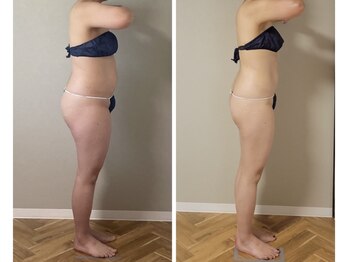 ラフォクシー(La.Foxy)/40代女性　4か月後には