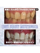 ライトビューティー 本八幡店(LIGHT BEAUTY)/お客様ビフォーアフター♪ 