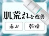 【乾燥｜赤み】乳酸菌ピーリング＆鎮静ケア(全顔)＆ヘッドスパ￥19800