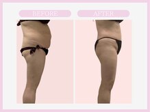 スリムライン 弘前店(The Slim Line)/before→after