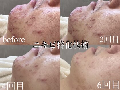 リグレア 新宿(Re.GLARE)の写真