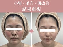 ルヴィアン 柏店(LUVIAN)