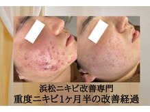 アエオボンヌール(A.E.O BONHEUR)