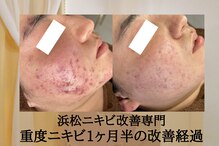 アエオボンヌール(A.E.O BONHEUR)