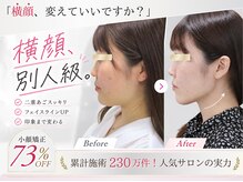 美デザイン 千葉駅前店(美.design)