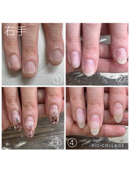 ラモ(RAMO)/ジェルをつけてから半年経過