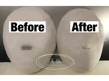 美極 トータルビューティー(美極 TOTAL BEAUTY)/恵比寿/小顔コルギ/エステ/