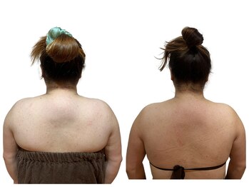 痩せラボ/大幅サイズダウン【痩身】