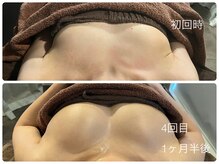 レクシートーキョー(LEXXXY TOKYO)/驚きと感動のバストケア