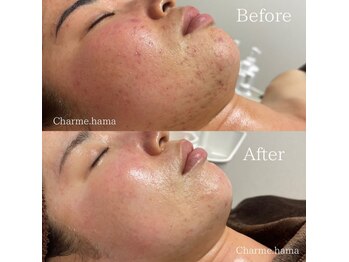 シャルム(Charme.)/