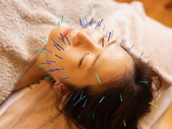 岩川治療院の写真/【表情筋バランスを整えスッキリしたフェイスライン】国家資格所持者による本格美容鍼！初めての方大歓迎◎