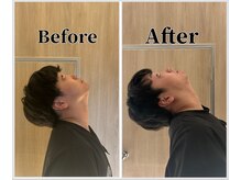 整体ラルース 中目黒(LALUZ)/30代 男性 ストレートネック改善