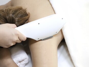 ベベ(Bebe)の写真/【脱毛結果に大満足！】「ここだけ脱毛したい」あなたにオススメ♪お好きなパーツを選べて悩みも解消◎