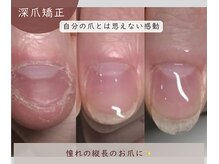 リネイル 川越(Re:NAIL)/自分の爪ってこんなに長いんだ！
