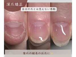 自分の爪ってこんなに長いんだ！