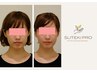 【整った輪郭へ】小顔3D整顔&肩こり・首こりケア