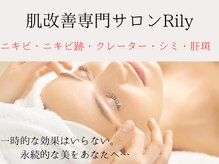 リリー(Rily)