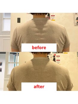 ナオル整体 福岡香椎院(NAORU整体)/50代女性施術事例【左肩下がり】