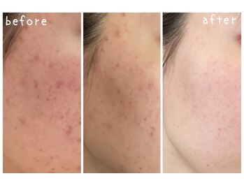 ビードット バイ ソーフライ(B.by So fly)/さまざまなお悩みに！