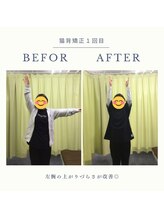 アミーゴ整体院/ビフォーアフター