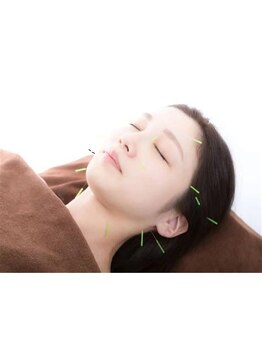 鍼灸施術を受けたい