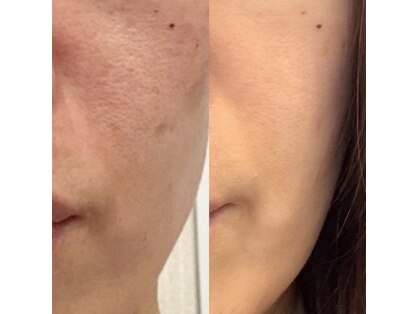 ビーユープロデュースバイエイチ(Be you produced by H)の写真