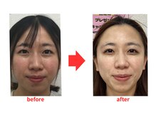 ブプラ 小倉店(BUPURA)/