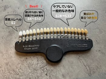 セルフダック 滋賀守山店(SELFDUCK)/歯のお色味