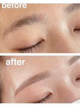 ダウニー(Downy)/20代/女性/看護師