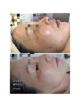 リバージュ(Riverge)/