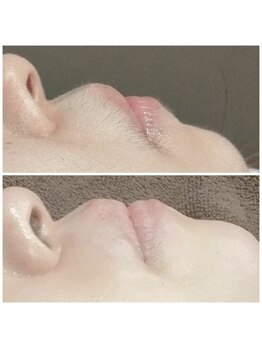 ムート(Mut.)/顔ワックス、シュガーリング脱毛