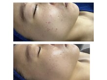 シルグラン(SIL gran)/リアボーテタラソ