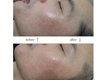 クリニカルエステクリア 梅田店