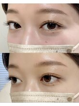 フー(fuu)/ブライダルエク+アイブロウwax