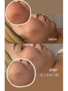 オーシャンブルーム 目黒(OceanBloom)/