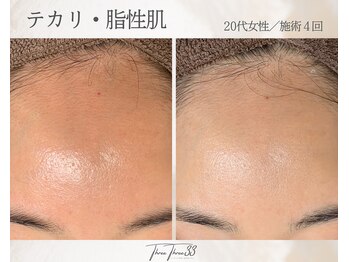 スリースリー(THREE THREE)/テカリ・脂性肌ケア