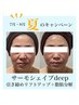 7月～8月【夏期キャンペーン】☆速攻小顔☆￥20,000→￥14,400