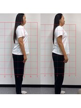 ハーモニーフィットネス 赤坂(Harmony Fitness)/姿勢改善