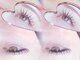 ローランリム(LORAN Lim)の写真