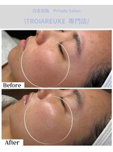 エミレーブ シロカネ(Hemireve Shirokane)/韓国肌管理TROIARUKE