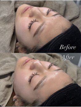 ロイジー(LUIZY)の写真/韓国肌を手に入れたい方必見！！フェイスワックスで肌本来の輝きをゲット◎