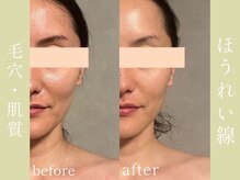 健志接骨院の雰囲気（【小顔矯正・肌質改善】フォトギャラリーに沢山お写真ございます）