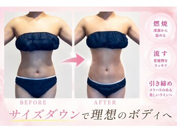 エクラ イオンモール徳島店(ECLAT)の写真/【集中ケア!当店人気No.1】痩せたいお客様はプロにお任せ下さい★理想のくびれとボディラインに！