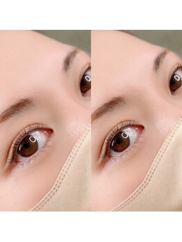 アイリス(eyeris)/ラッシュリフト