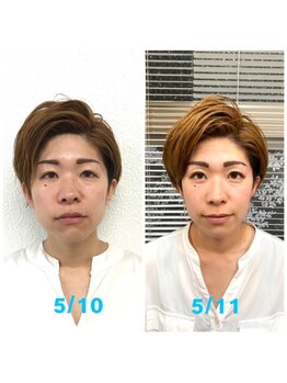 ビューティスタジオＫ/キュッと小顔