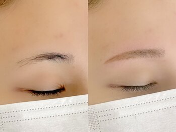 ミュウ(Mu)/7)お顔全体wax