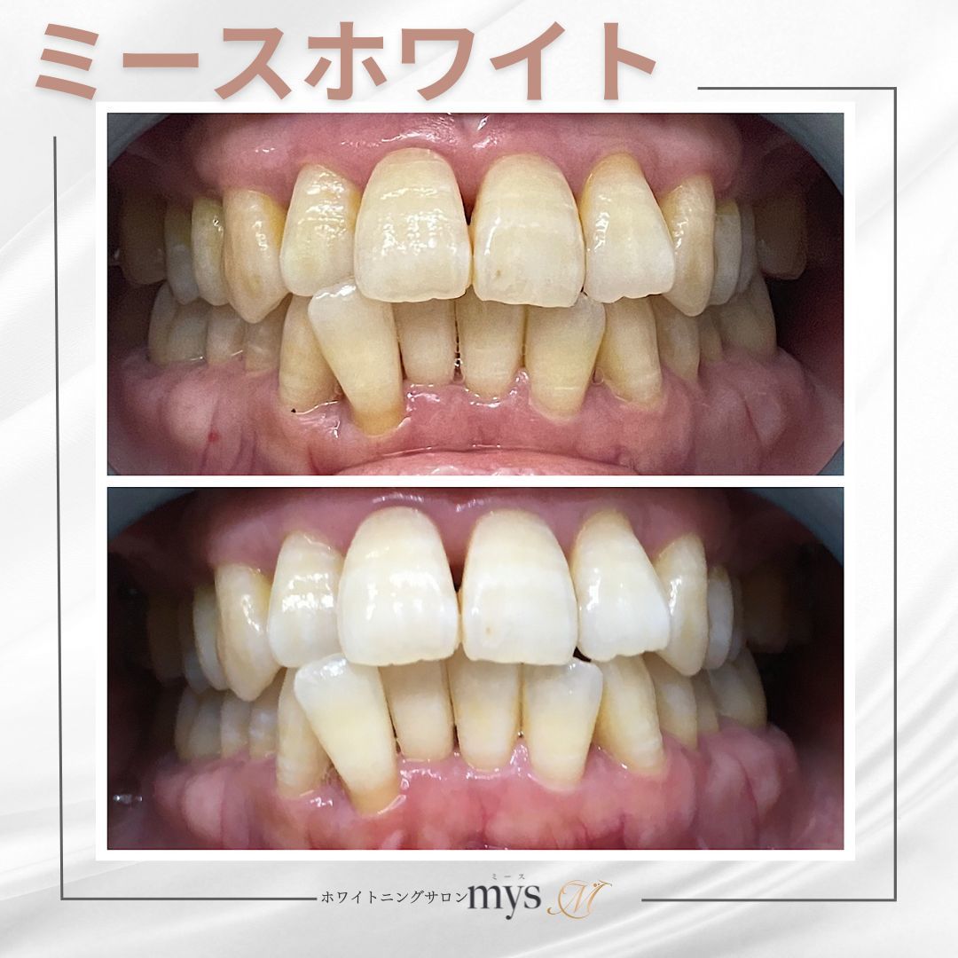 コース契約済みの方はこちらよりご予約ください