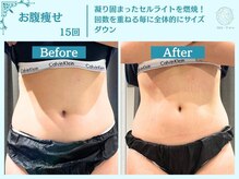 圧倒的な結果を出し、あなたの「理想の身体」を叶える！フローフシ∞のオーダーメイド痩身