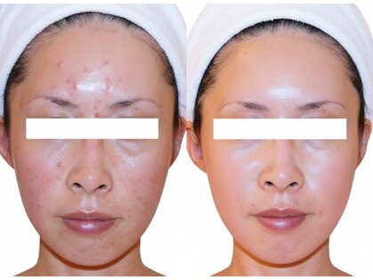 ピュアノア 三木店の写真